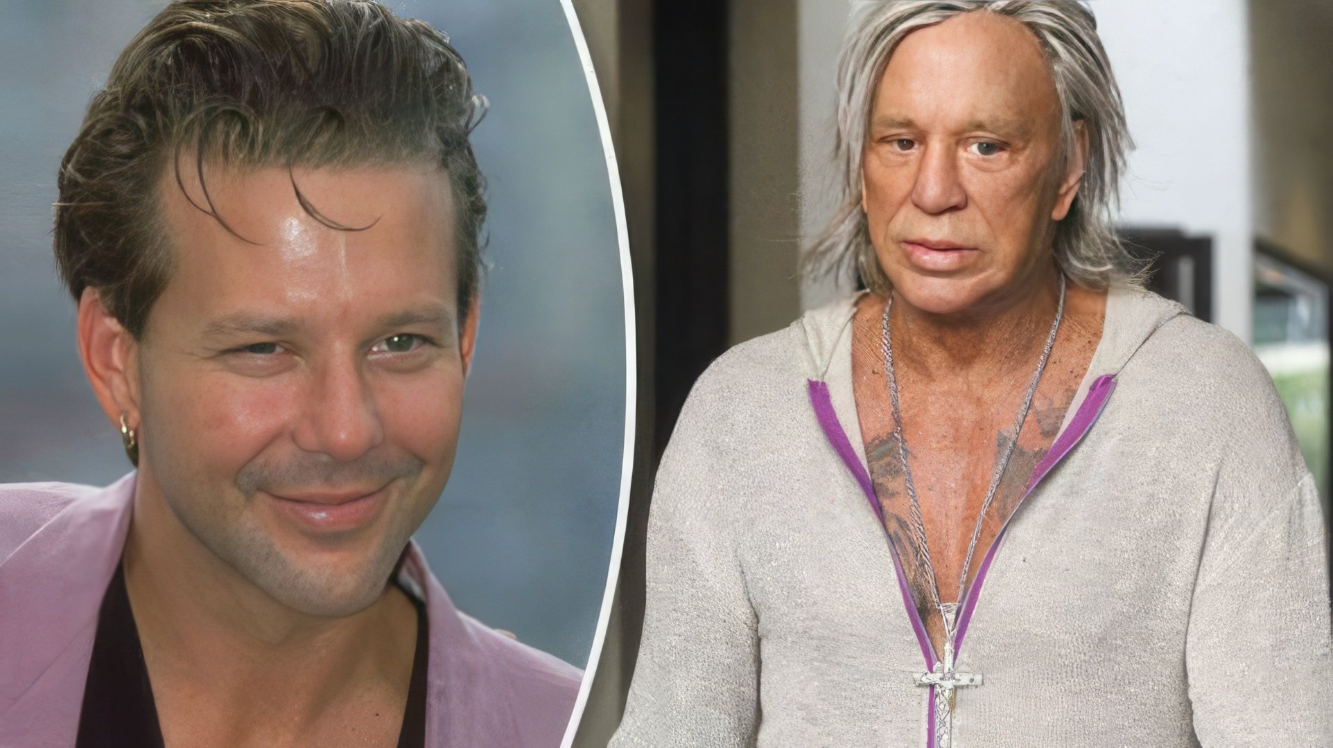 Mickey Rourke Antes y Después de la Cirugía Plástica