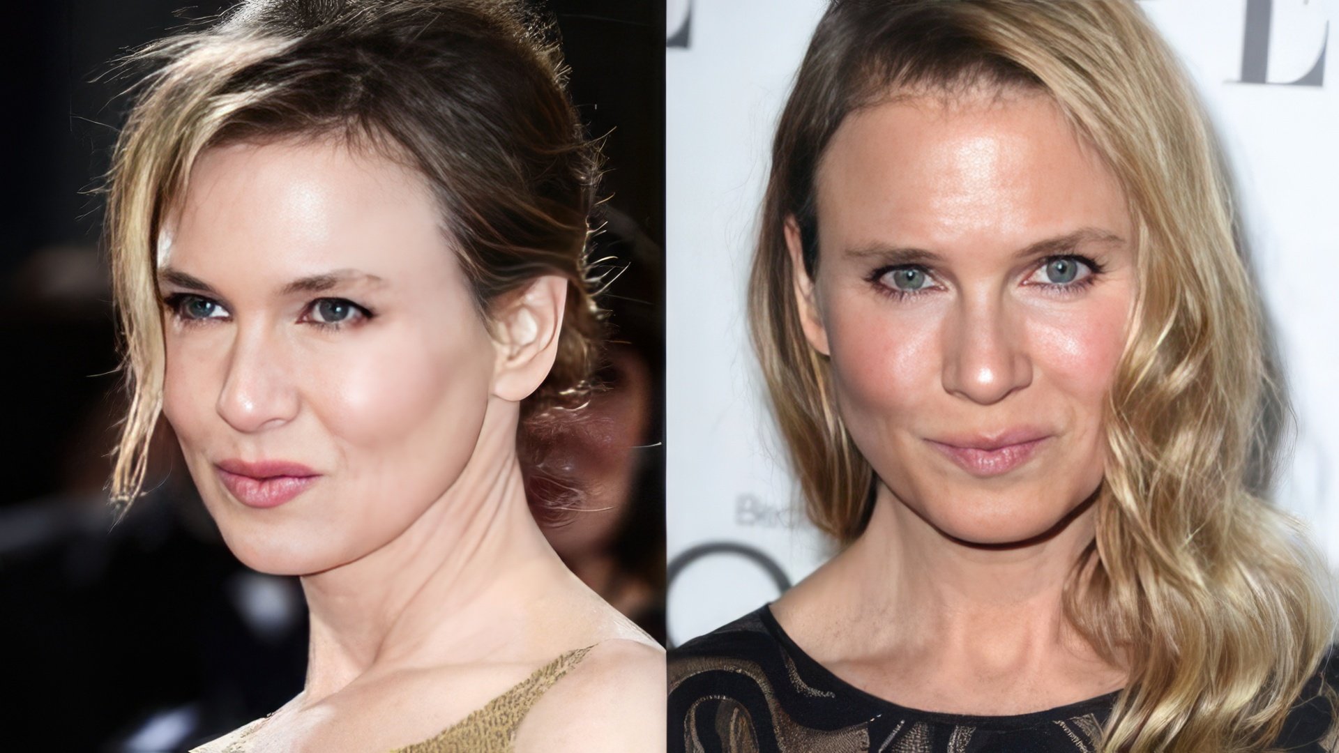Renee Zellweger antes y después de la cirugía