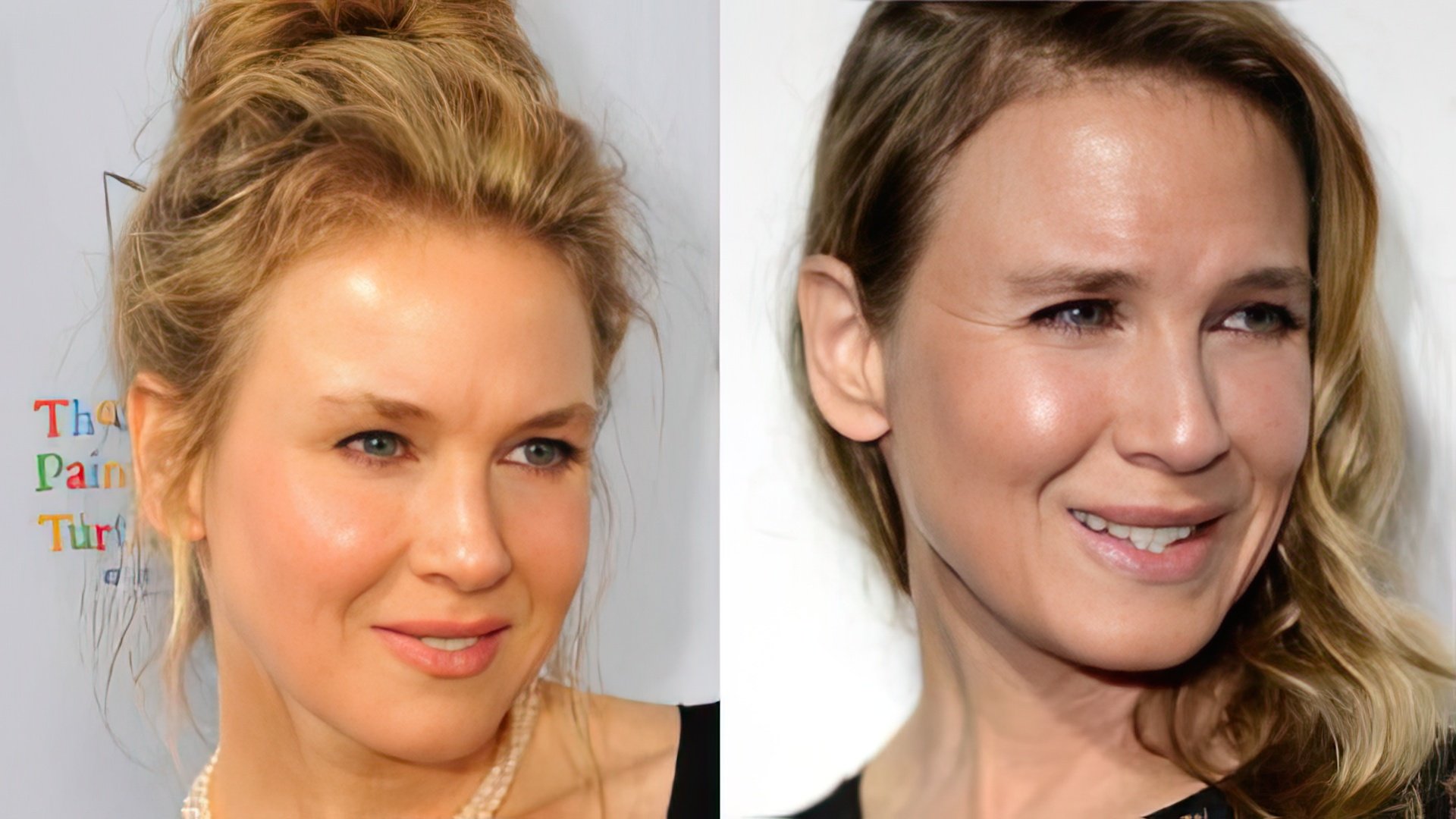 Muchos creen que Renee Zellweger arruinó su apariencia con cirugía.